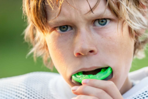 Guide on Mouth Guards