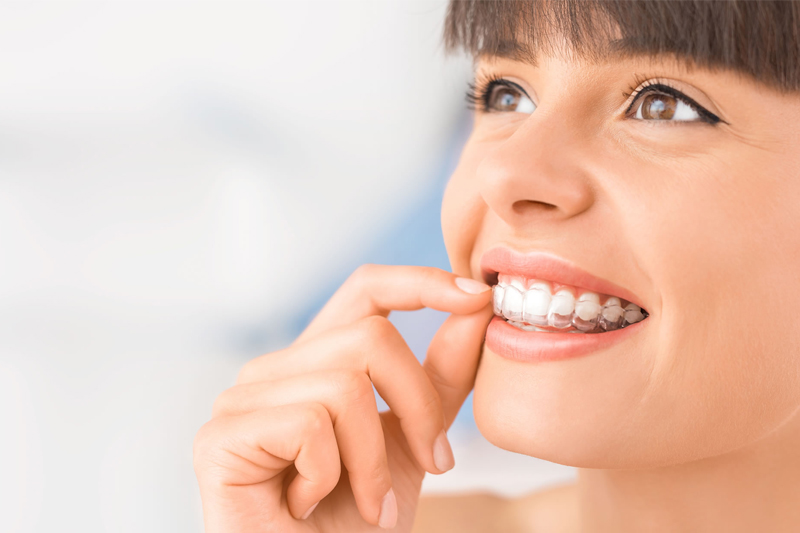 How-Long-Does-Invisalign-Take-to-Straighten-My-Teeth