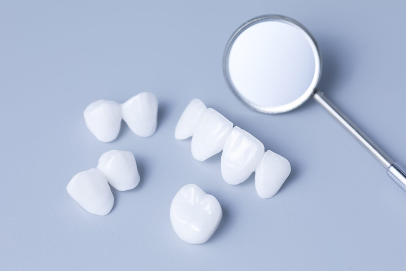 The-Benefits-Of-Cosmetic-Airdrie-Dental-Veneers