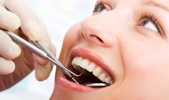 dental_fillings_image