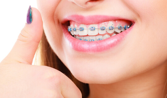 orthodontics image