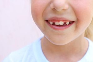 reasons for crooked teeth in kids