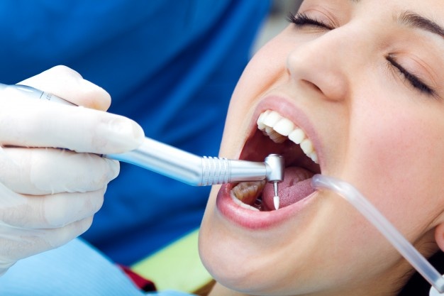 how to care for your dental fillings