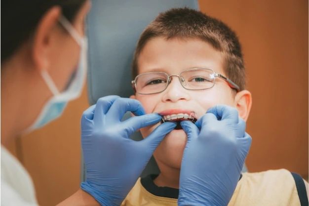 question about kids braces answered by Airdrie dentist