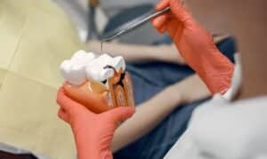 root canals dentist in Airdrie - South Airdrie Smiles