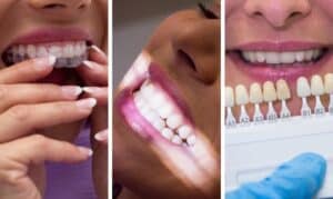 the advantages of cosmetic dentistry airdrie ab - south airdrie smiles