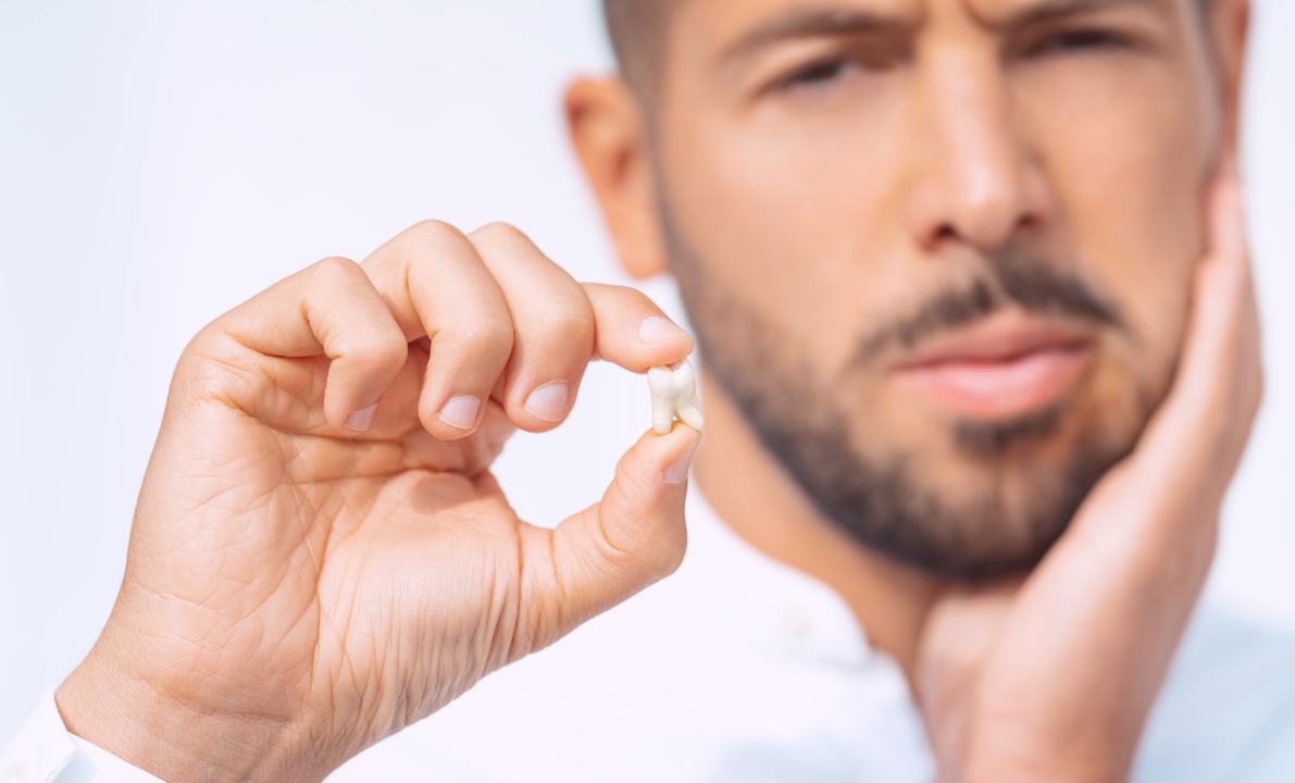 Diet After Wisdom Teeth Removal: What You Can Eat and What to Avoid