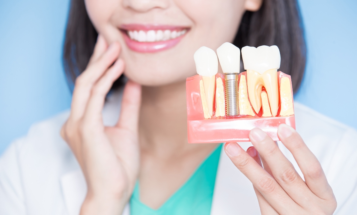 How Can Dental Implants Improve Your Quality of Life in Airdrie