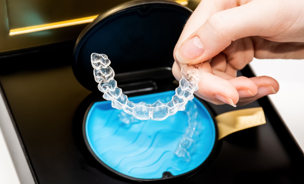Open-Bite Correction Braces or Invisalign Which Works Best