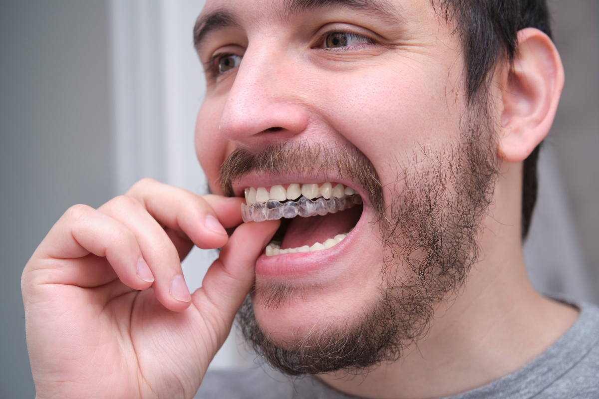 Invisalign-in-Airdrie