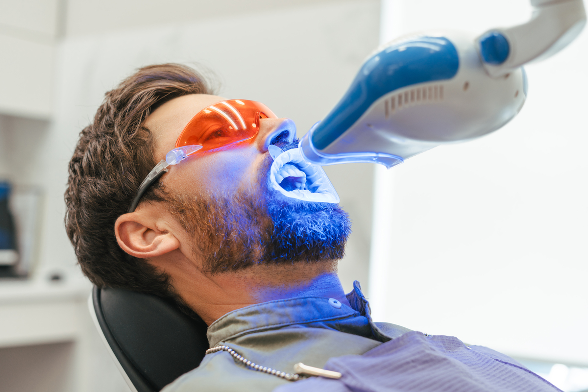 teeth-whitening-in-Airdrie